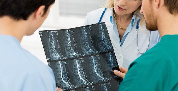 Рентгенография на гръбначния стълб като начин за диагностика на остеохондроза