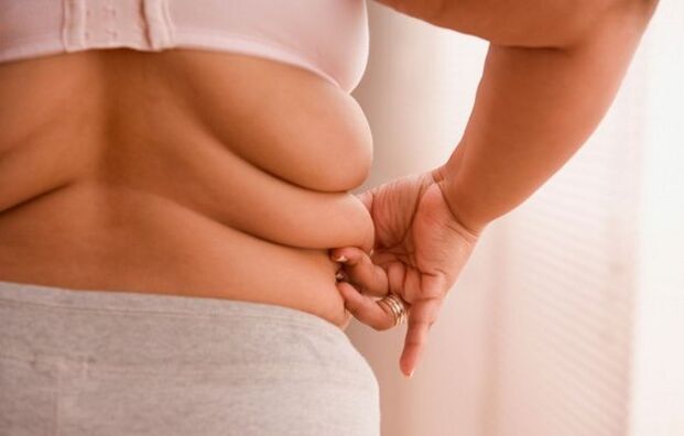 наднормено тегло, причината за цервикална остеохондроза при жени под 40 години