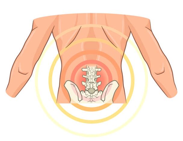 остеохондроза на лумбалната част на гръбначния стълб